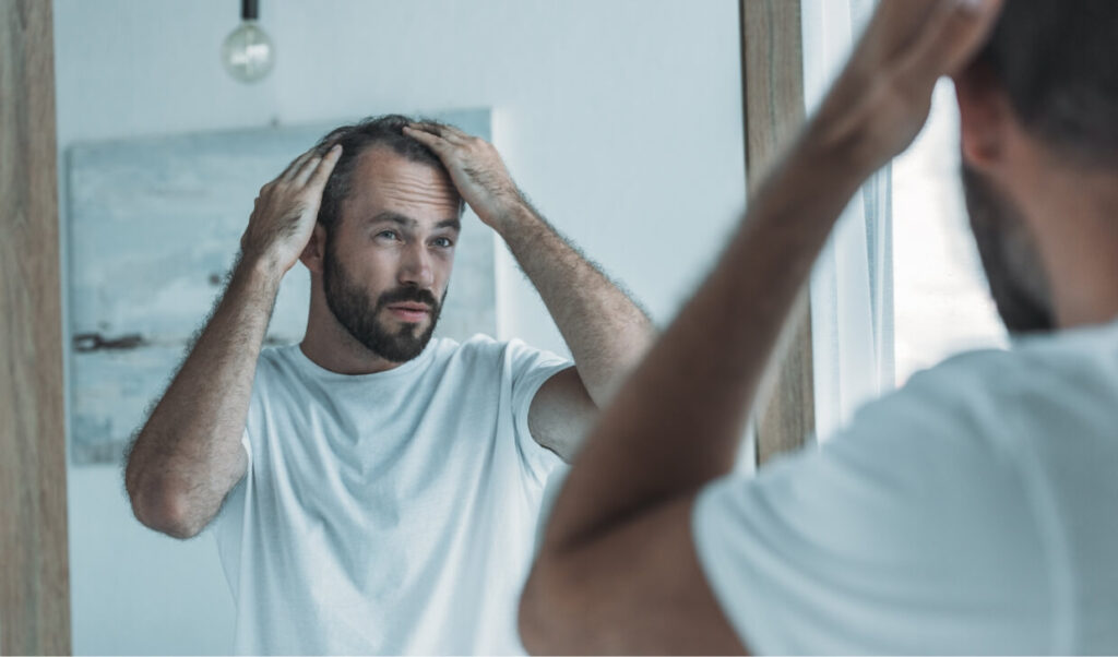 cropped-shot-of-middle-aged-man-with-alopecia-look-2024-11-17-14-09-44-utc (1)